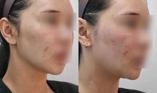 온다 전후 — 청주오창점