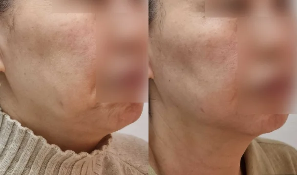 온다 전후 — 청주오창점