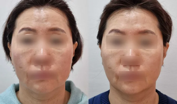 온다 전후 — 청주오창점