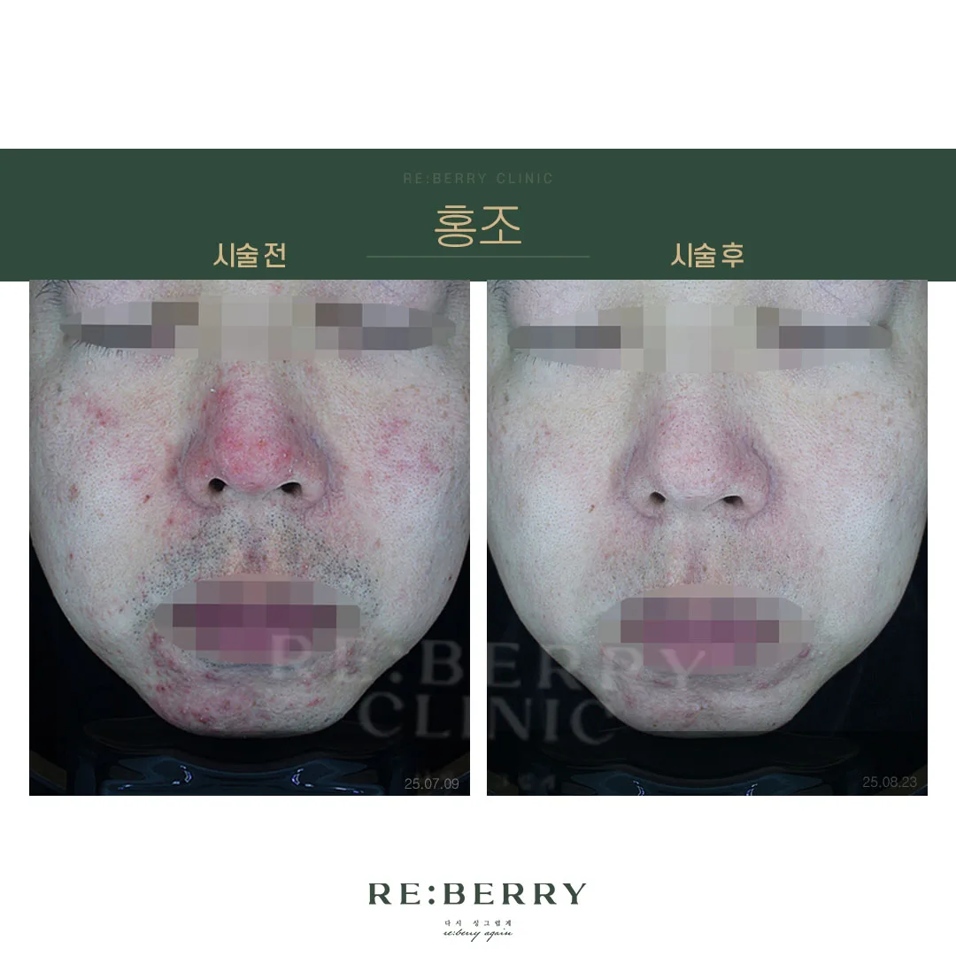 홍조 전후 — 오창점 김태균원장