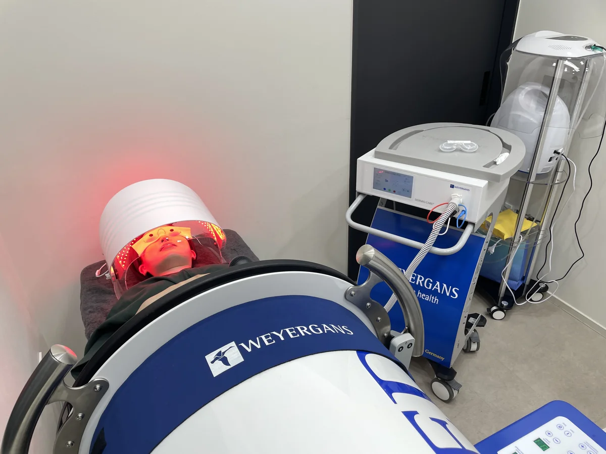 Preparation for stretch mark laser treatment