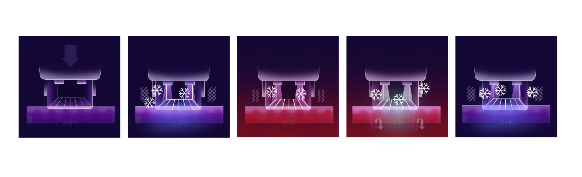 Thermage FLX AccuREP technology real-time impedance measurement diagram