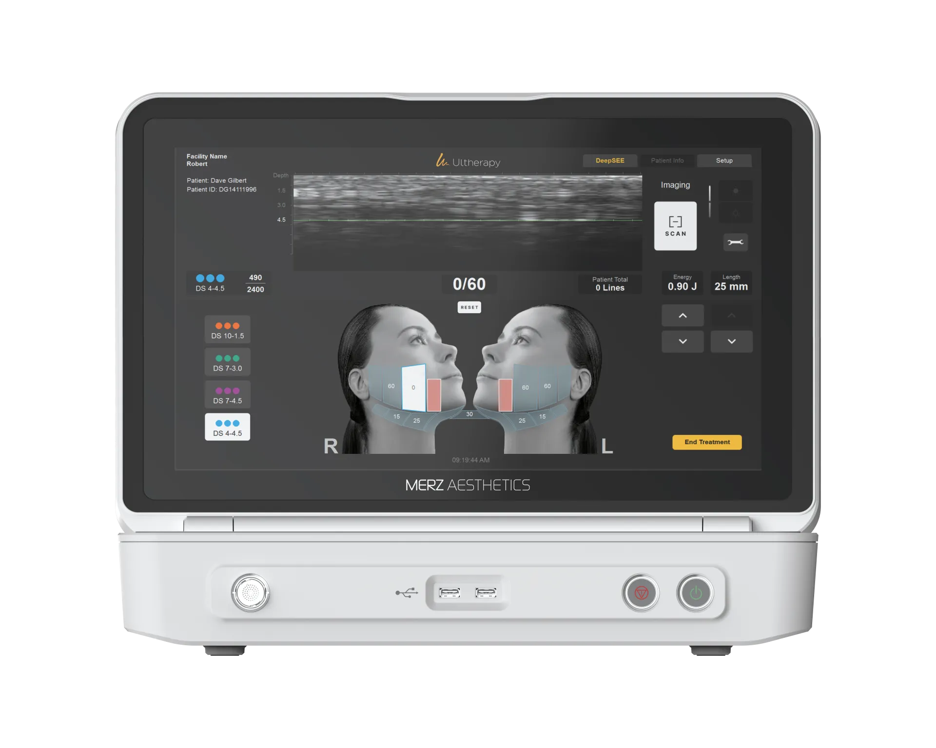 Ultherapy Prime HIFU device for periorbital eye lifting at RE:BERRY Gangnam Korea