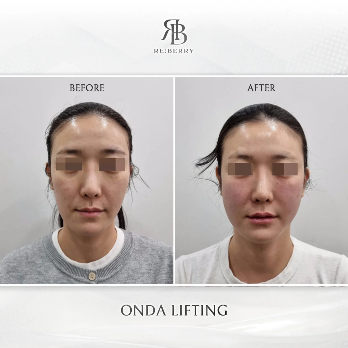 Lifting — before & after at RE:BERRY