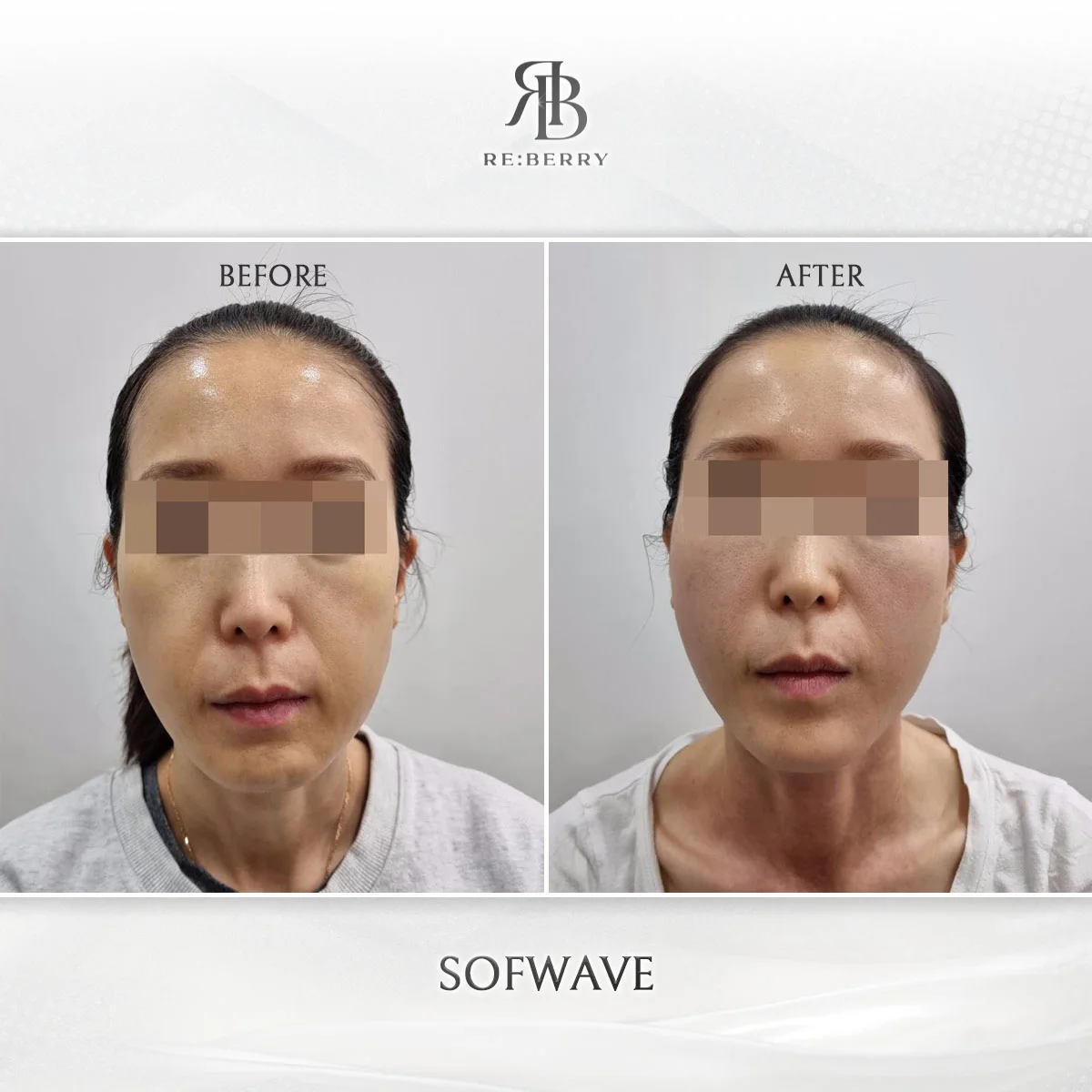 Lifting — before & after at RE:BERRY