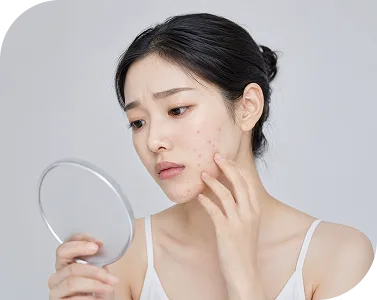 여드름 피부과 추천은 어떻게 선택하나요?