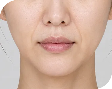팔자주름 필러 가격은 얼마인가요?