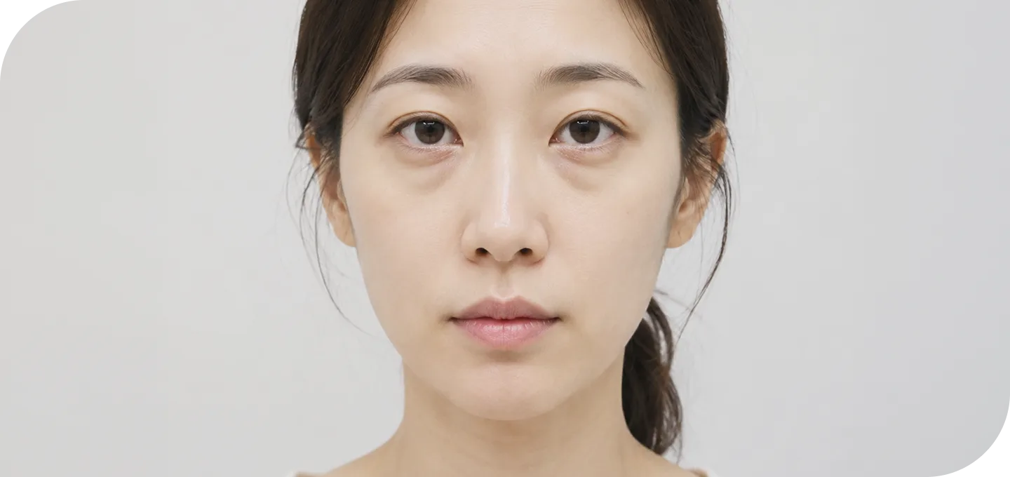 눈밑필러 영종도 가격은 얼마인가요?