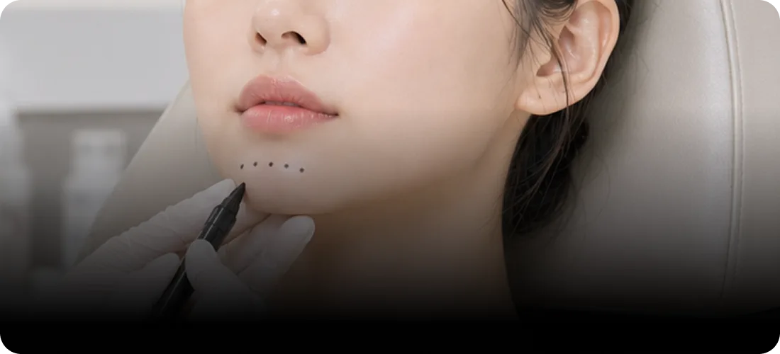 STEP 2. 주입 포인트 설계