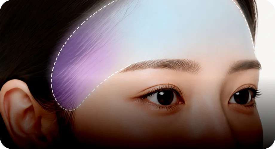 관자놀이 연속성 회복