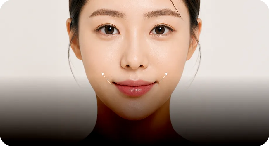 마리오네트 라인 개선
