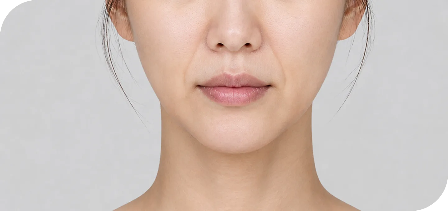 팔자주름 필러 가격은 얼마인가요?
