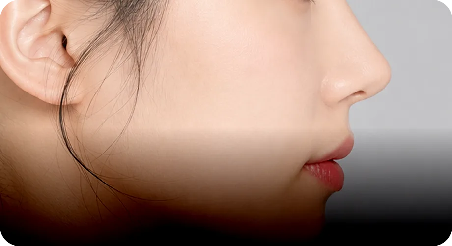 즉각적인 콧대 볼륨 형성