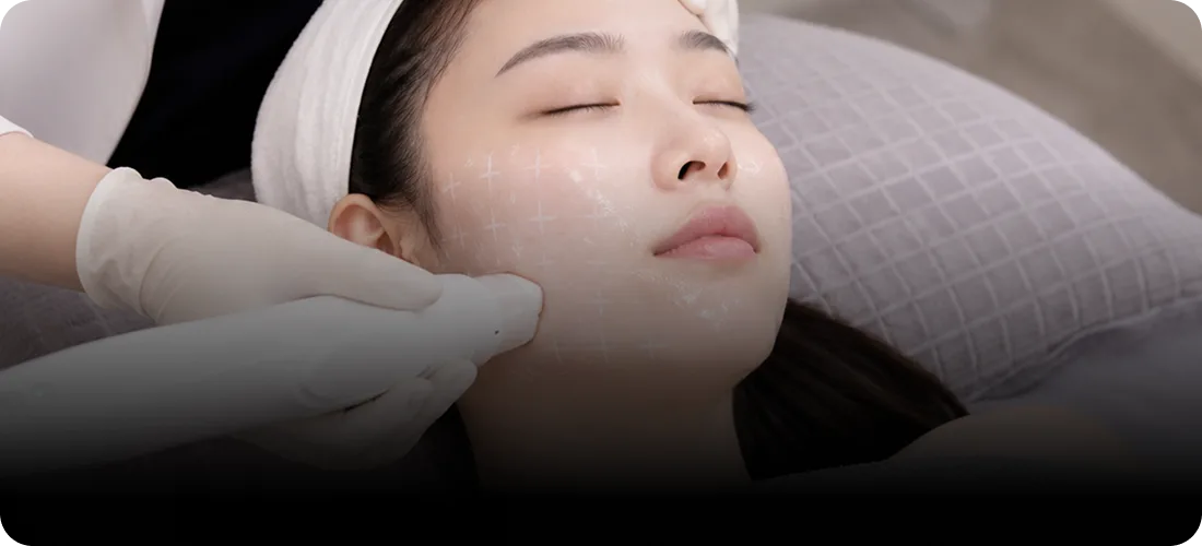STEP 3 — 볼뉴머 시술