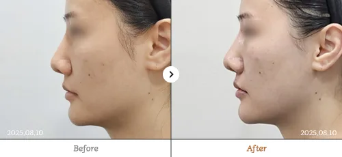 레비나스,울쎄라 전후 — 명동점 백승재원장