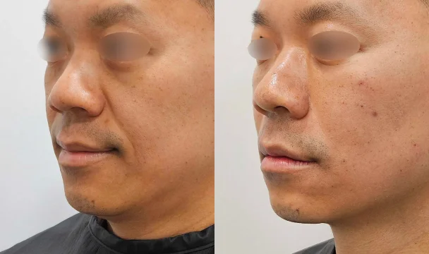 리볼르 전후 — 명동점