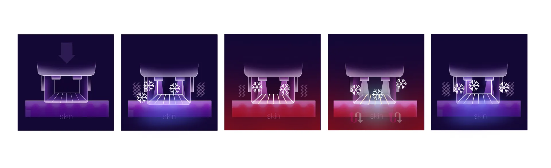 热玛吉FLX AccuREP智能射频操作过程 院长亲自操作 RE:BERRY明洞