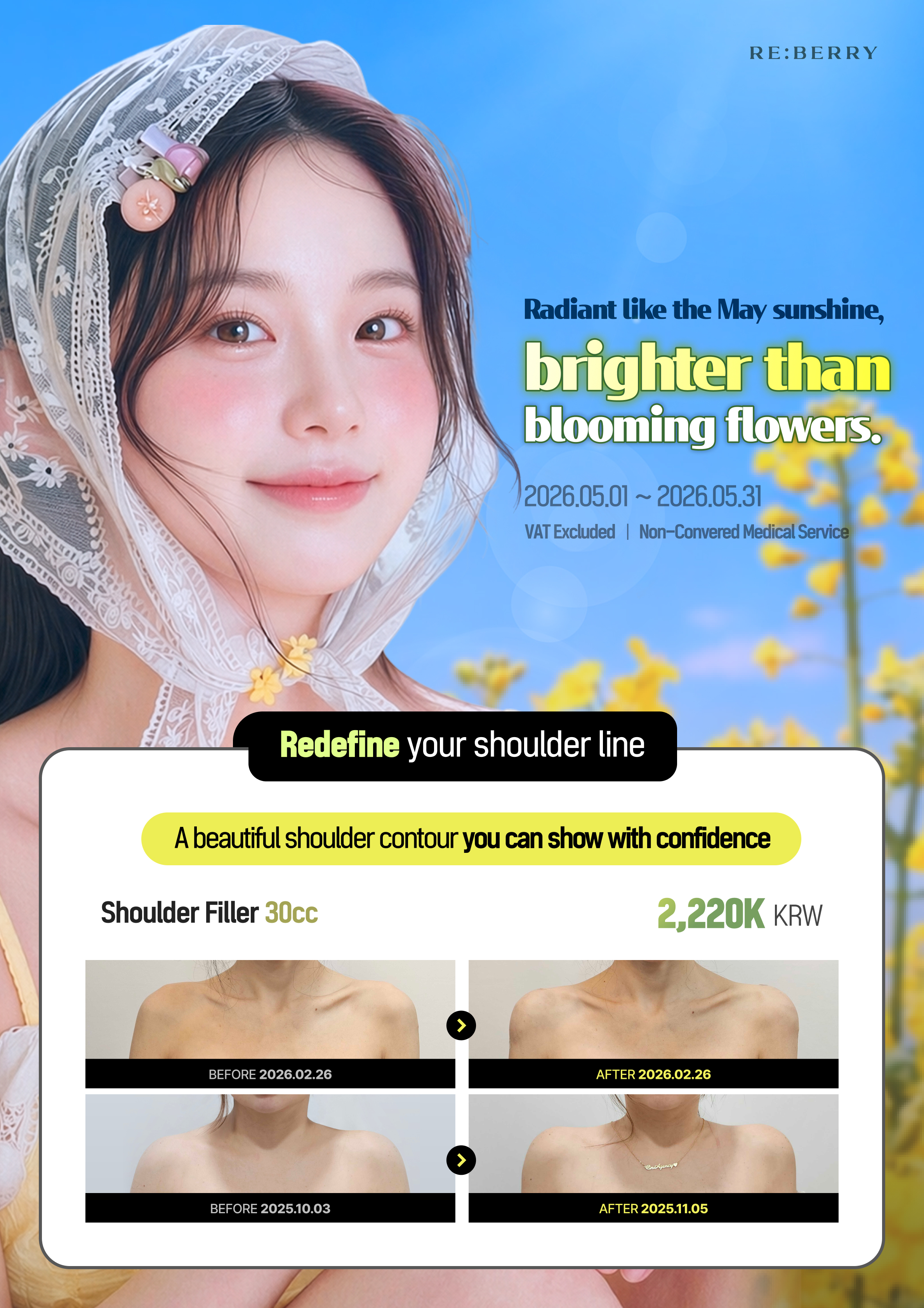 RE:BERRY Myeongdong May 2026 Promotion Page 11 — Special offers and pricing