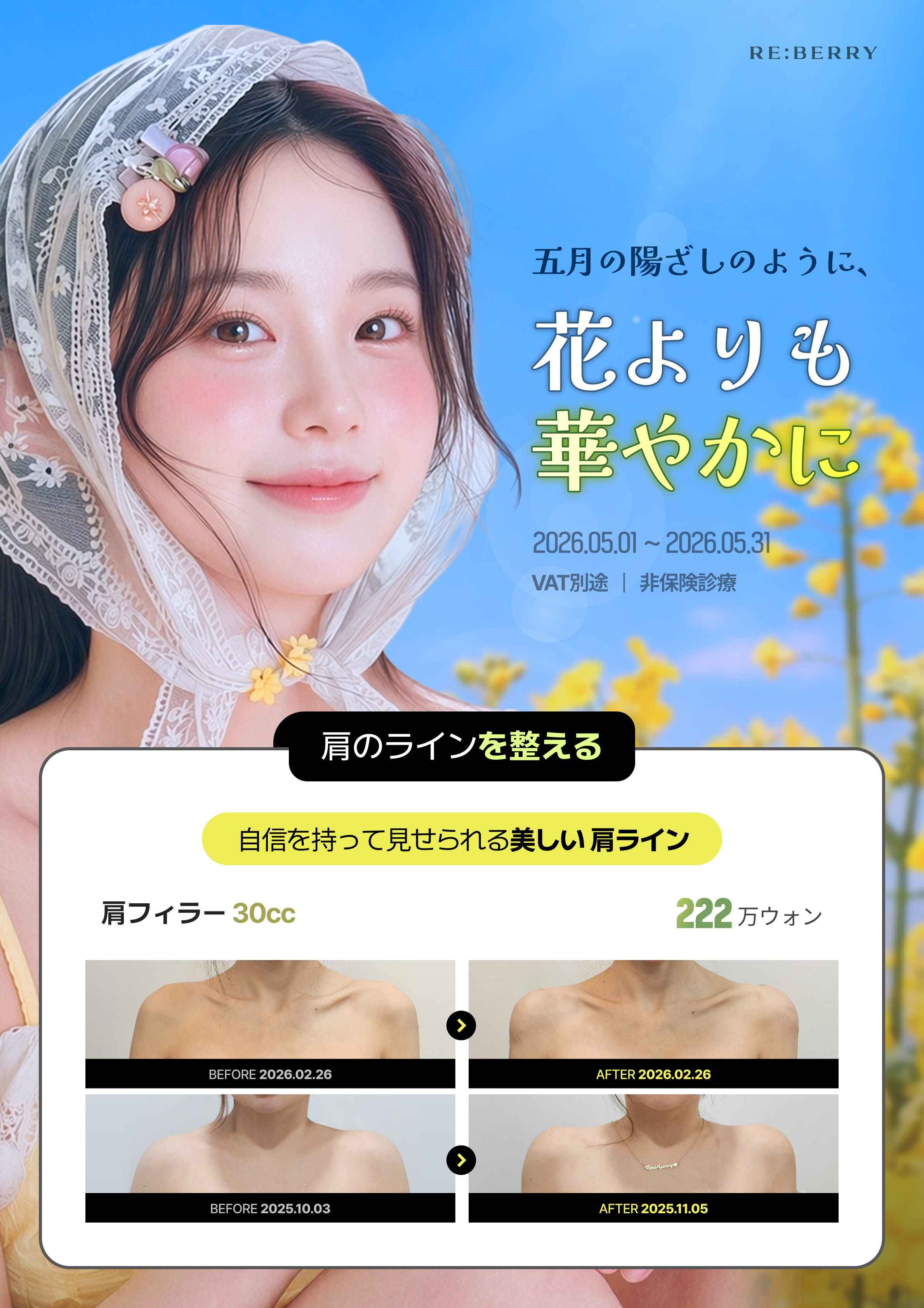 RE:BERRY 明洞 2026年5月キャンペーン ページ11 — 特別オファー