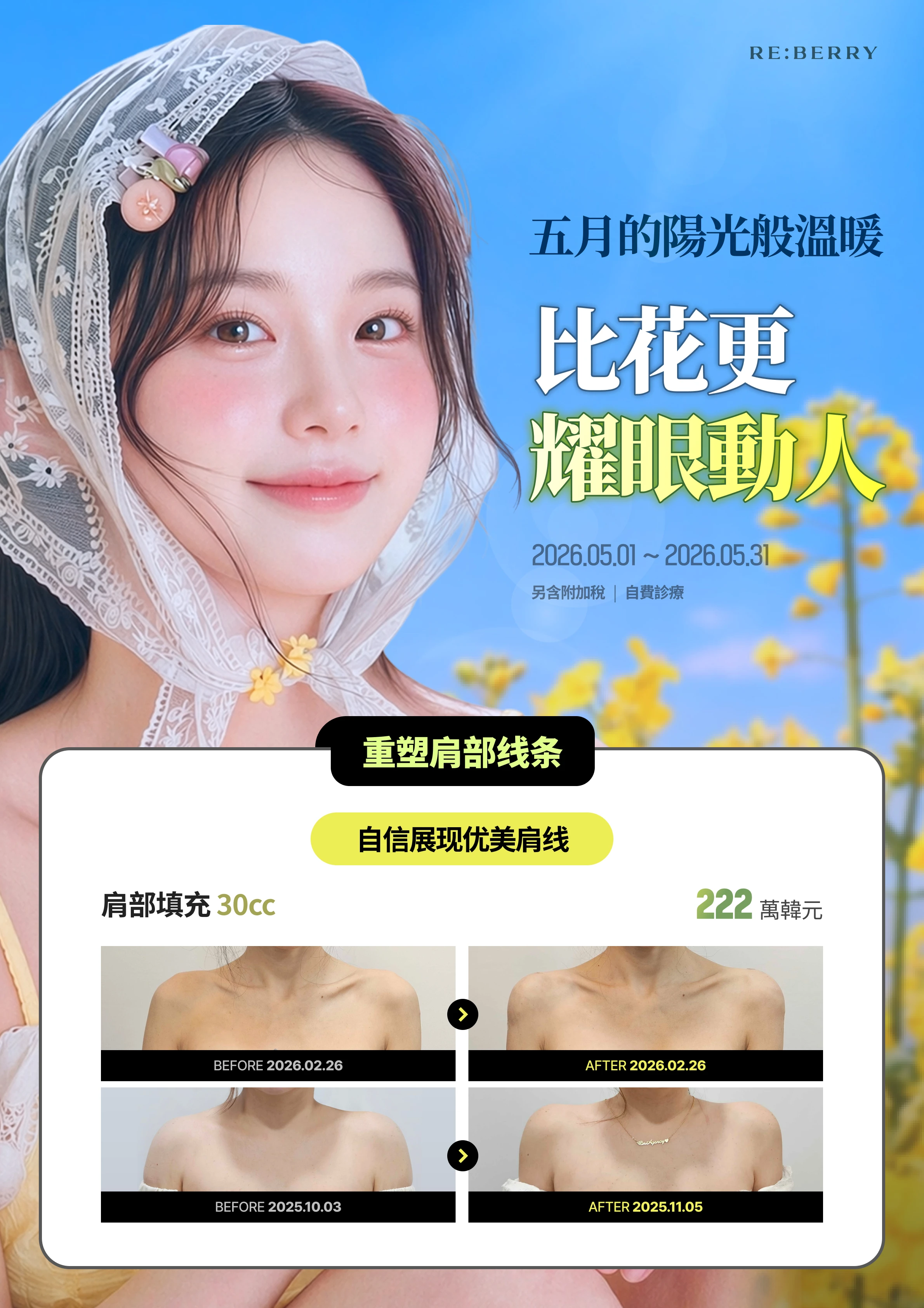 麗貝瑞RE:BERRY明洞2026年5月優惠 第11頁 — 精選方案